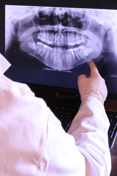Best Emergency Wisdom Tooth Extraction in Polkton, NC